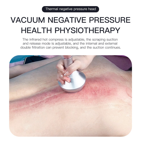 SQ52 Pro 6-en-1 – Cavitation 80K, RF, massage sous vide et plaques laser