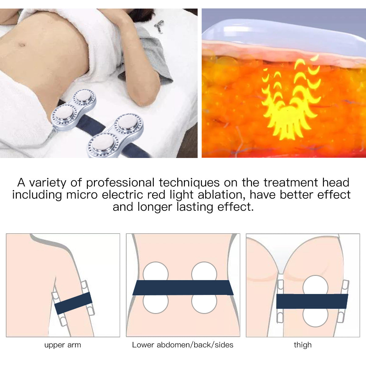 SQ47B Pro 6-en-1 – Cavitation 40K, trois RF, massage sous vide et plaques EMS laser