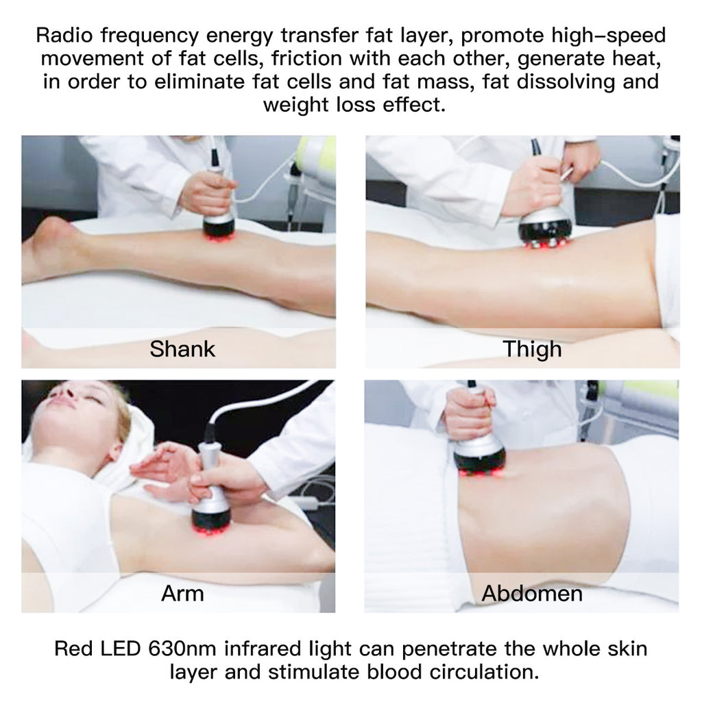 SQ47B Pro 6-en-1 – Cavitation 40K, trois RF, massage sous vide et plaques EMS laser