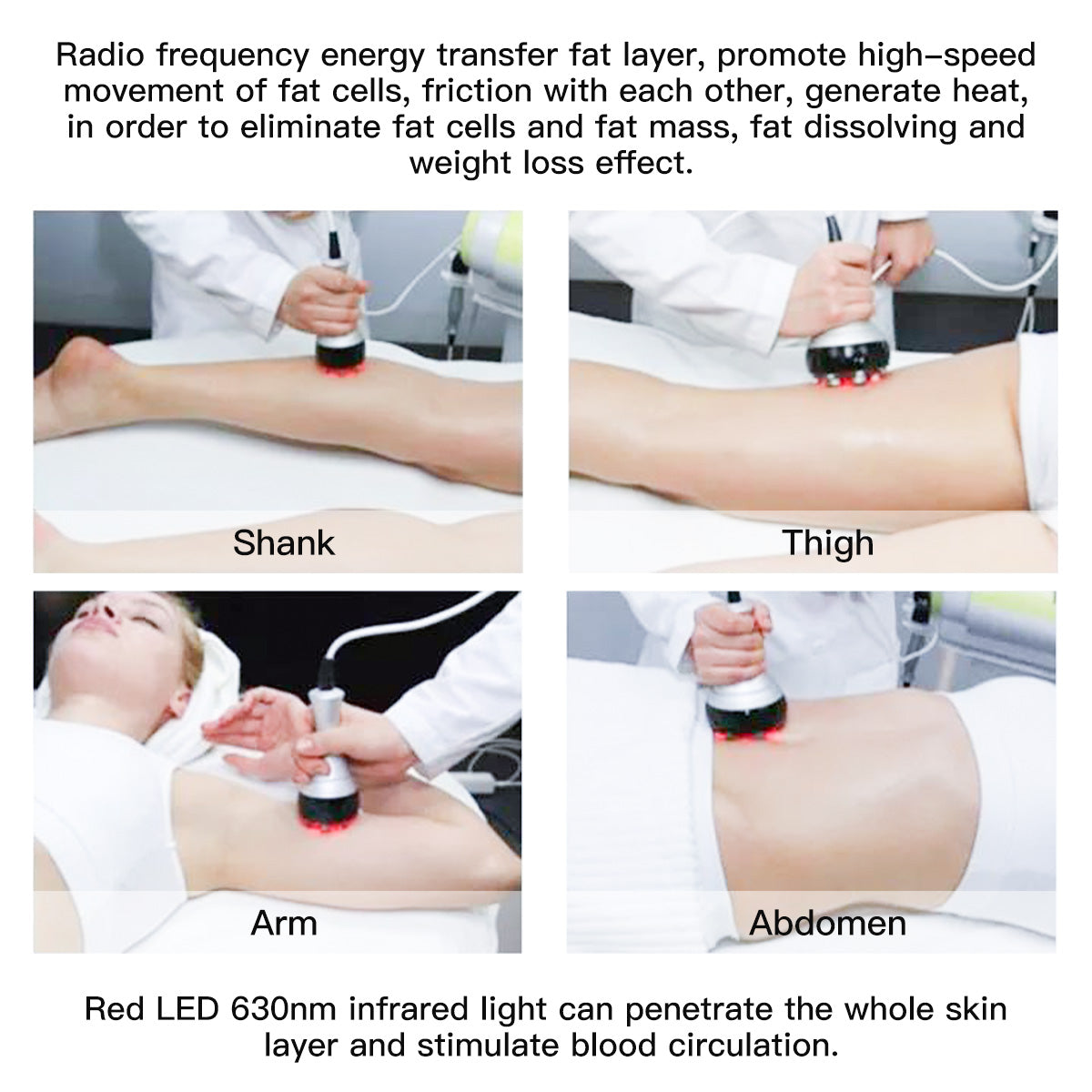 SQ47B Pro 6-en-1 – Cavitation 40K, trois RF, massage sous vide et plaques EMS laser