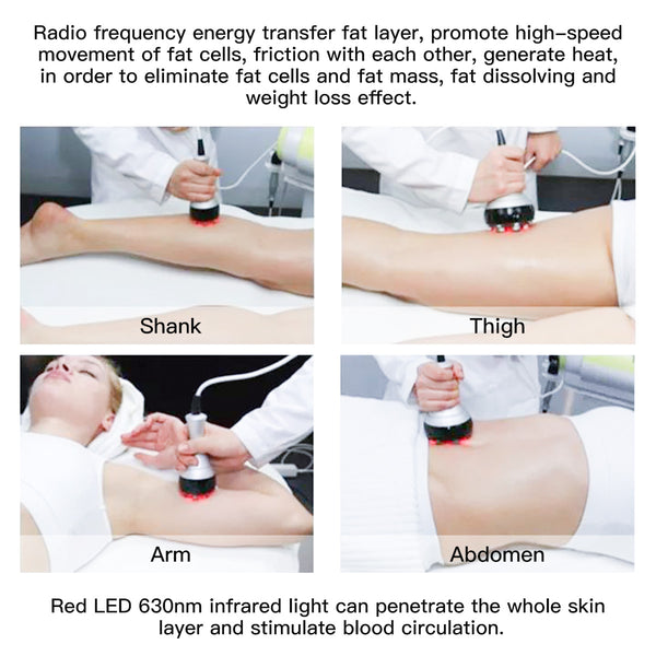 SQ47B Pro 6-en-1 – Cavitation 40K, trois RF, massage sous vide et plaques EMS laser