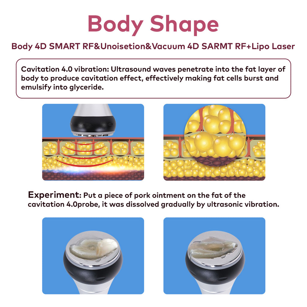 SQ16B Basic – Appareil silhouette 4-en-1, cavitation 40K, RF et vide