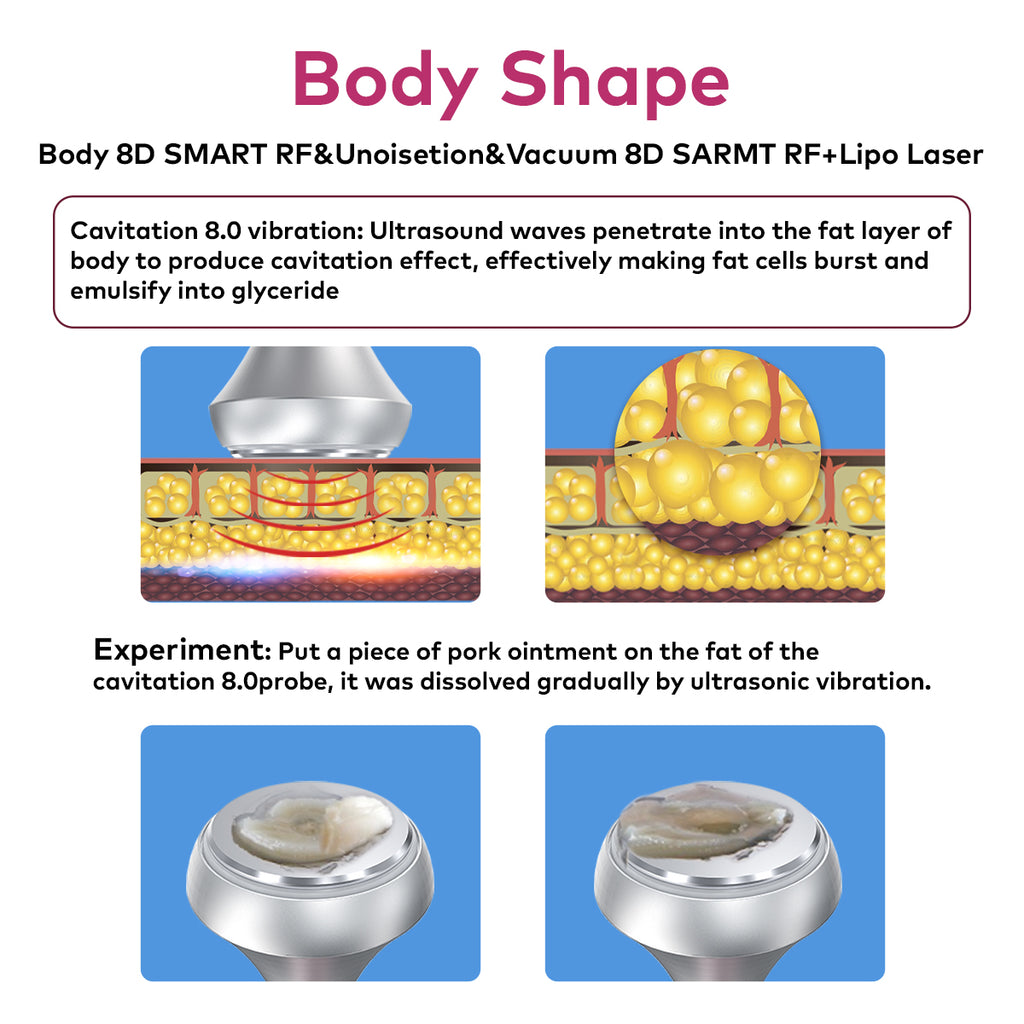 SQ121C Plus – Appareil silhouette 9-en-1, cavitation 80K, RF, EMS et LED