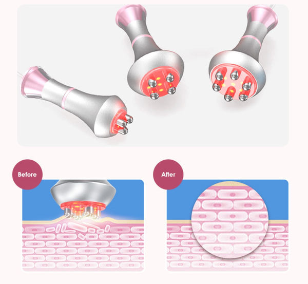 SQ121B Pro – Appareil silhouette 6-en-1, cavitation 80K, RF et microcourants