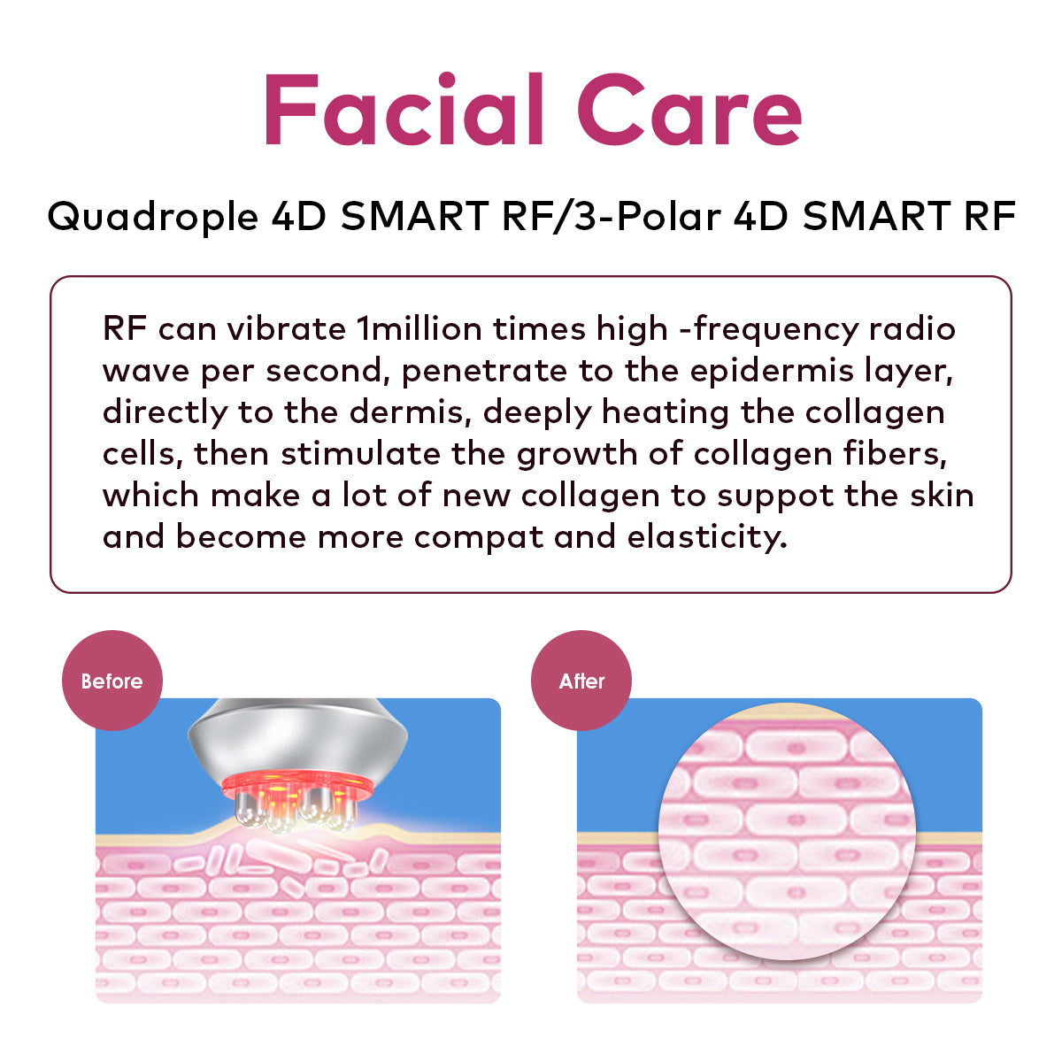 SQ121D Plus – Appareil silhouette 9-en-1, cavitation 80K, RF et microcourants